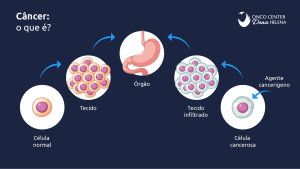 Ilustração explicativa sobre o que é câncer, mostrando a progressão de uma célula normal para uma célula cancerosa. A imagem inclui as etapas: célula normal, tecido, órgão, tecido infiltrado, e célula cancerosa. Também destaca a presença de um agente cancerígeno.
